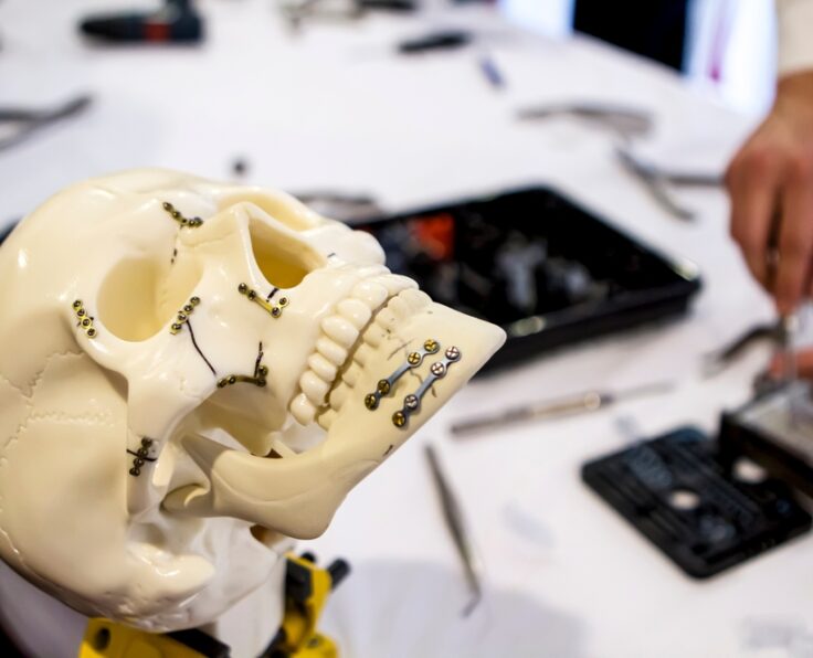 Skull,Models,Being,Used,To,Train,Surgical,Residents,To,Treat