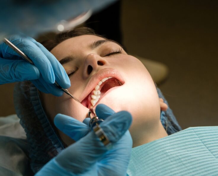 Dental,Surgeon,Performs,Conduction,Anesthesia,With,Lidocaine,Using,A,Carpool